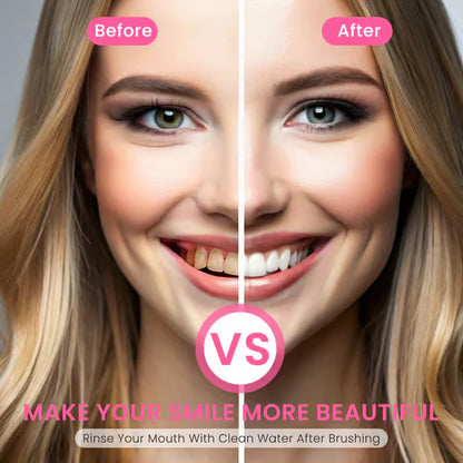 🔥Nicotinamide Probiotic Whitening Toothpaste - Free of Fluoride, Nicotinamide, Anti plaque